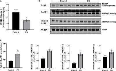 Calcitriol Alleviates MPP+- and MPTP-Induced Parthanatos Through the VDR/PARP1 Pathway in the Model of Parkinson’s Disease